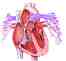 interventricular 
