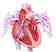 coartacin de aorta
