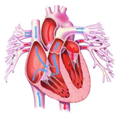 coartacin de aorta