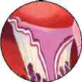 PROLAPSO v. mitral  zoom