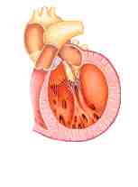 estenosis aortica