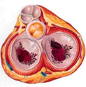 val. aorta remplazo valvular