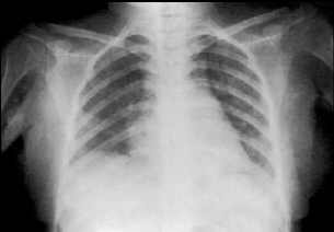 radiografa  derma