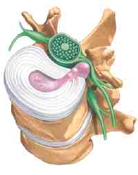 Duele el cuello y da bajo la oreja