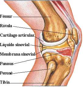 LESION CARTILAGO ARTICULAR lesion cartilago articular: