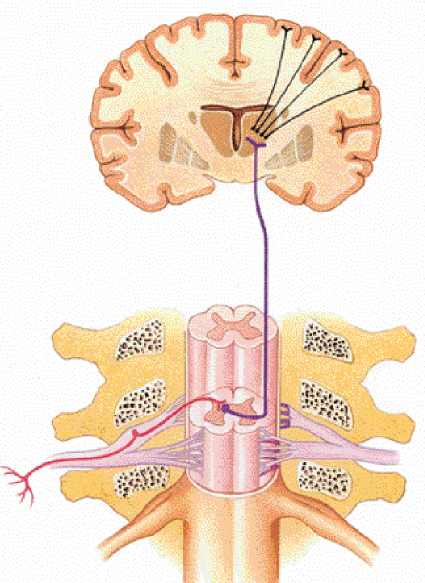 radicular