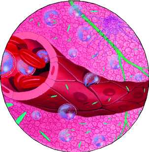 inflamaci�n hueso