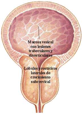 subcervical.jpg (17558 bytes)