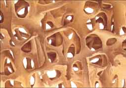 tejido oseo osteoporosis