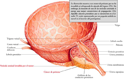 C�ncer de pr�stata