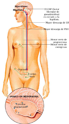 Menopausia