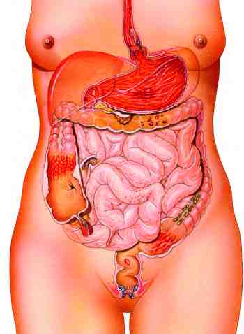 emorragia digestiva