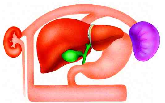 metabolismo hiperproduccio copy