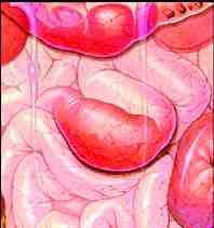 dolor abdominal completo