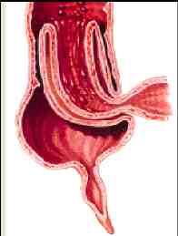 invaginacin