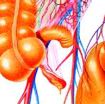 peritonitis supurando