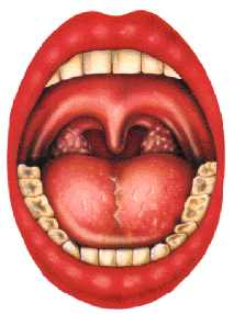 AMIGDALITIS